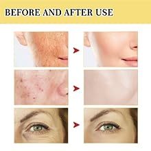 Snail Mucin Power Essence Moisturizer Serum For Face With Snail Secretion