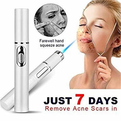 Blue Light Therapy Acne Laser Pen Soft Scar Wrinkle Removal Treatment Device - 16th Avenue
