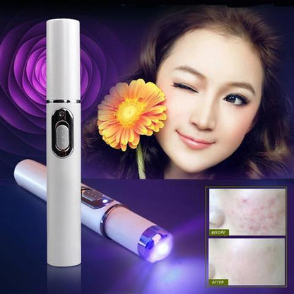 Blue Light Therapy Acne Laser Pen Soft Scar Wrinkle Removal Treatment Device - 16th Avenue