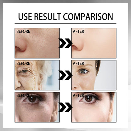 Snail Cream Fading Wrinkle French Lines Replenishment Firming Skin Anti-Aging - 16th Avenue